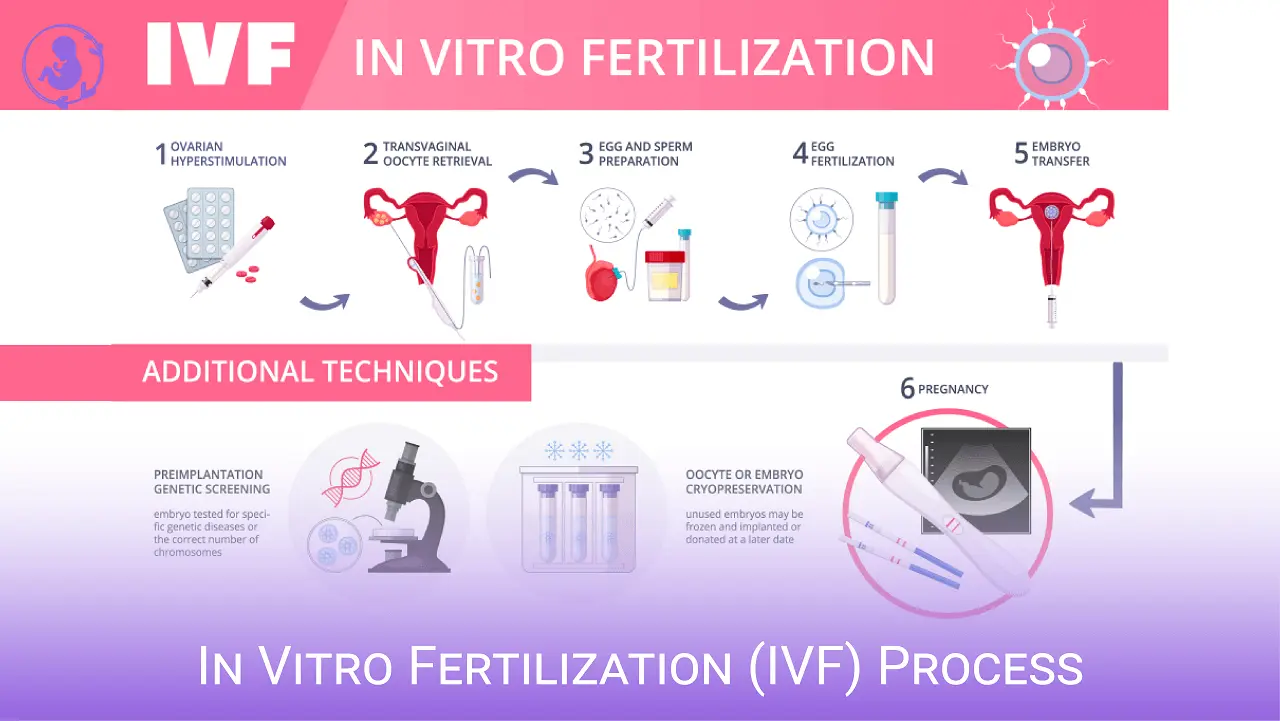 In Vitro Fertilization (IVF) Process - Step by Step IVF Cycle