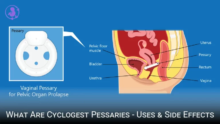 What are IVF Cyclogest Pessaries